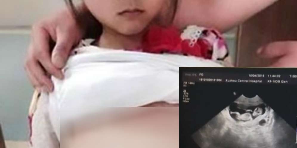 Bocah Usia 12 Tahun Hamil, Saat Dibawa ke Dokter Ternyata...