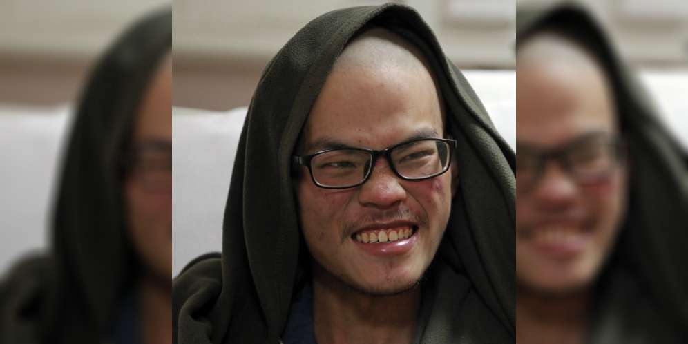 Kaki Busuk Dimakan Belatung