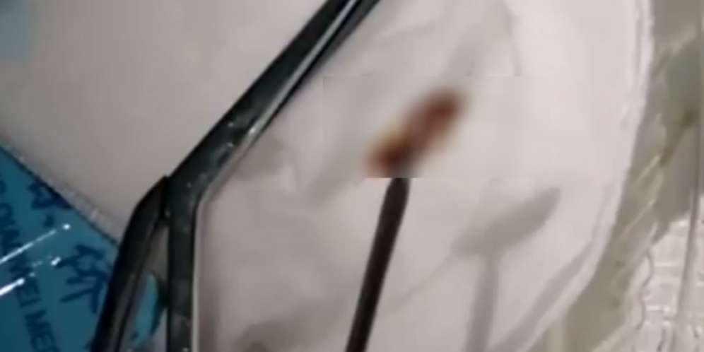 Shock, Masih Tak Percaya