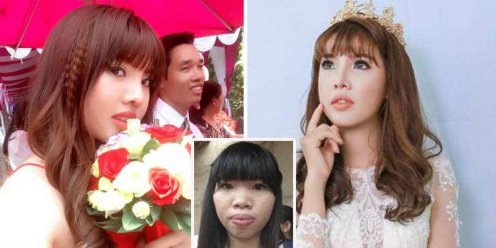 Dulu Dihina, Kini Gadis Itu Cantik dan Dinikahi Pria Kaya Raya