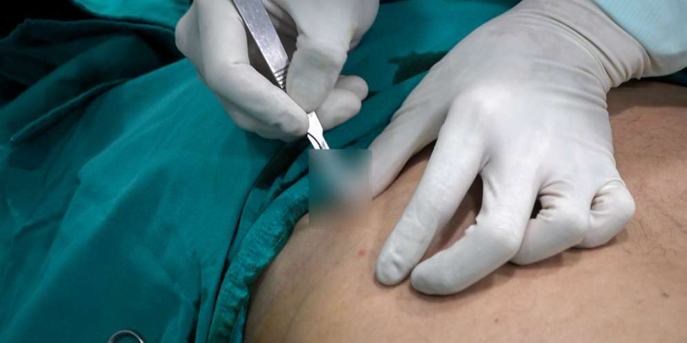 Rata-rata Benda Stainless