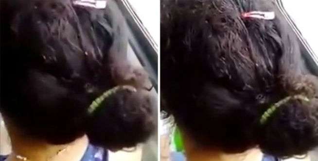Cara Atasi Rambut Berkutu