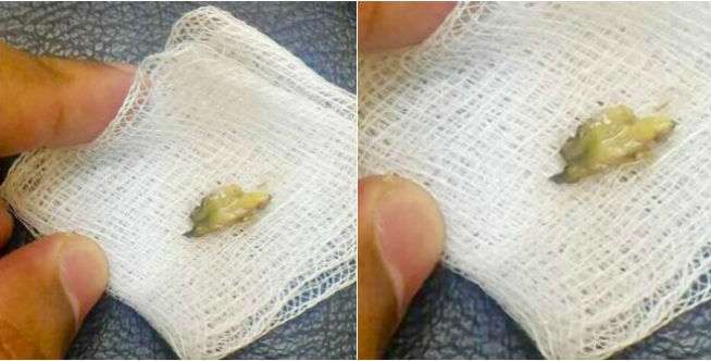Kebiasaan Pakai Cotton Bud