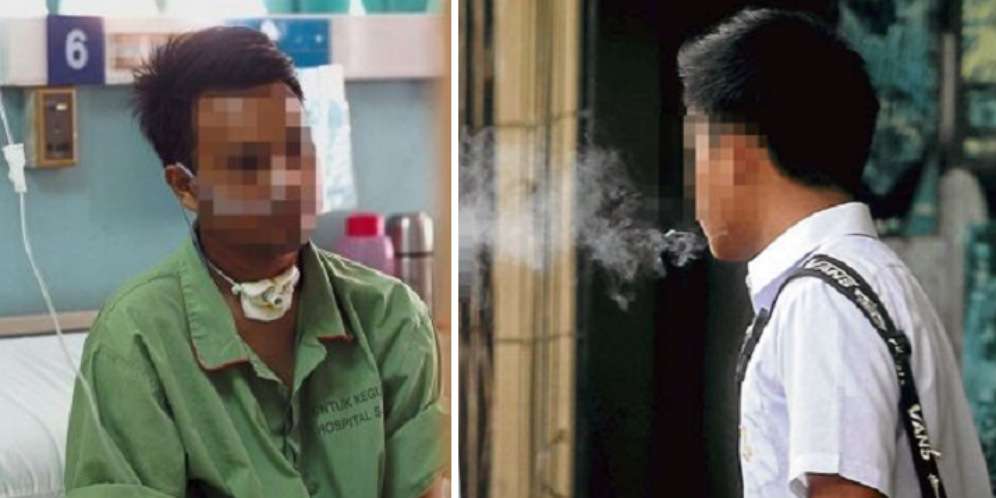 Tenggorokan Dilubangi