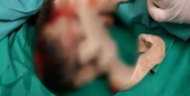 Dokter Temukan Benda Keras di Perutnya