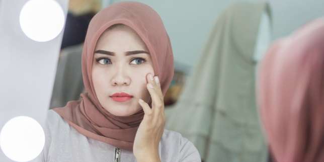 Cara Mengatasi Jerawat Secara Alami