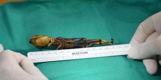 Benarkah Bayi Alien?