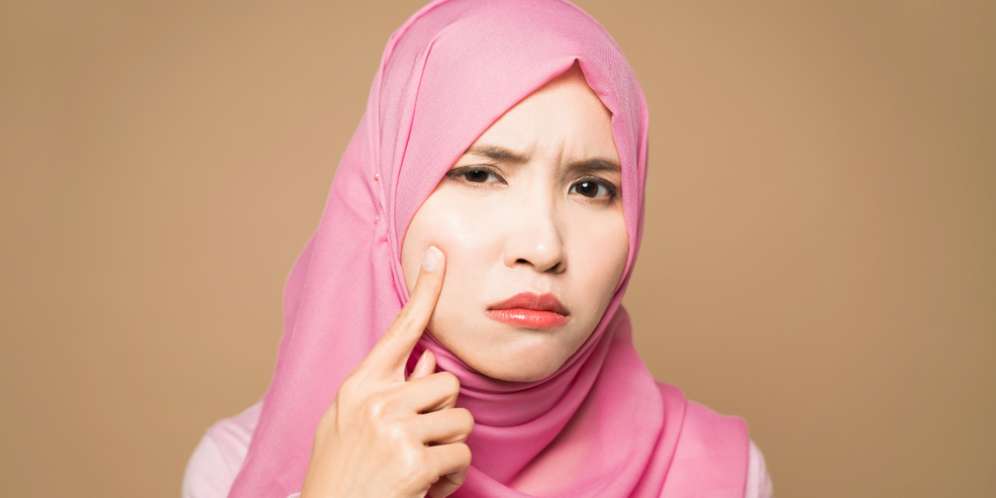 Jika Tak Ingin Jerawat Makin Parah, Coba Tips Ini