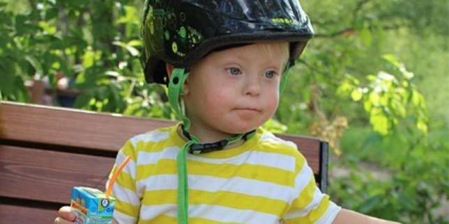 Penyebab Down Syndrome