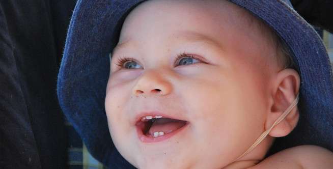 Gigi Bayi Juga Bisa Berlubang
