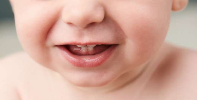 Wajib Tahu, Dasar Penting Merawat Gigi Anak