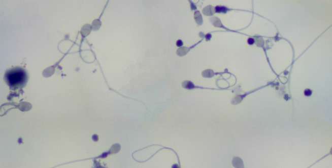 Pria yang suka pakai boxer