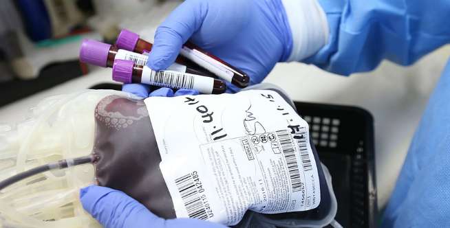 Awalnya Donorkan Darah untuk Mertua