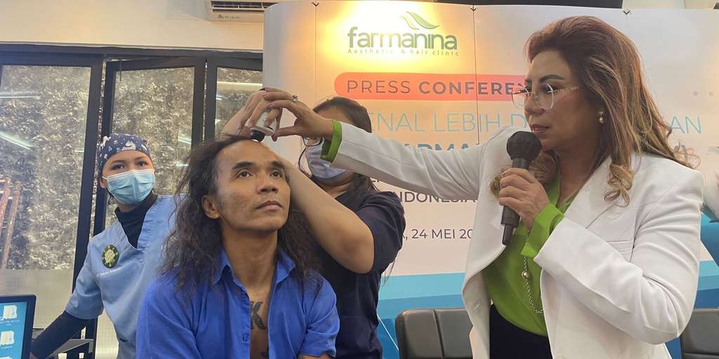 Apa Itu Transplatasi Rambut?