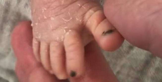 Tak Bisa Bedakan Bayi Kembarnya, Ibu Beri Cat di Jari Kaki