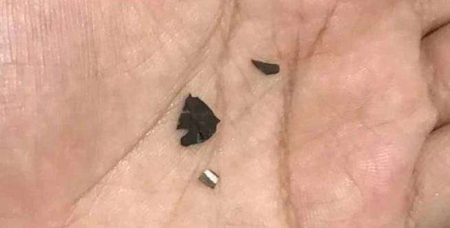 Serpihan Silet Masuk Lambung