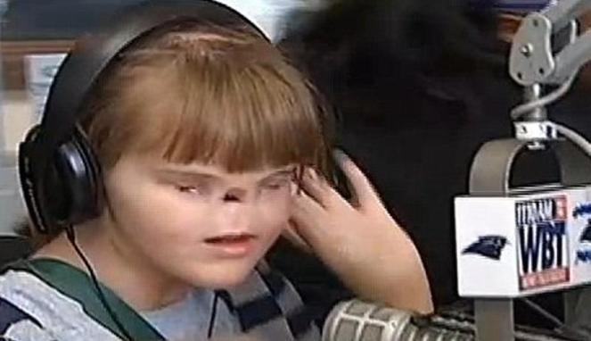 Kisah Penyiar Radio Tanpa Mata dan Hidung