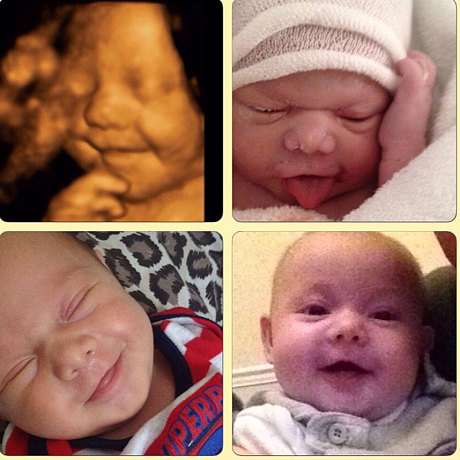 Bayi Ini Sudah Suka Senyum saat Masih di Kandungan Bayi Ini Sudah Suka Senyum saat Masih di Kandungan