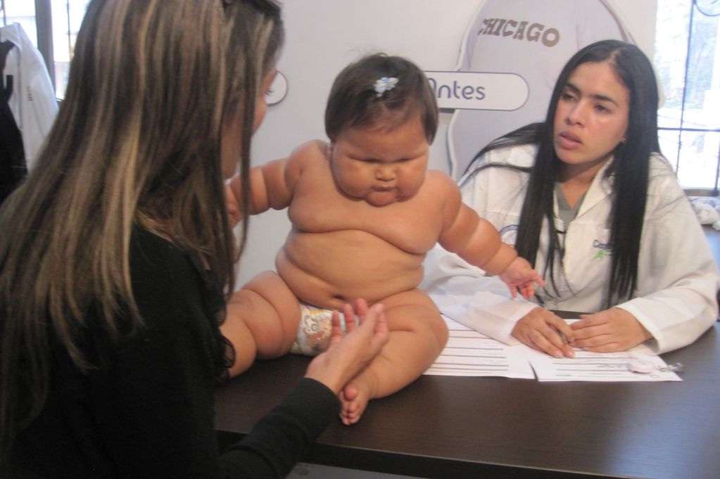 Usia Belum Setahun, Bayi Ini Berbobot 20 Kilogram