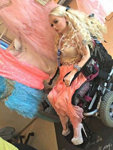Subhanallah, Ini Manusia Barbie Lumpuh Pertama di Dunia