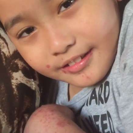Buah Hati Terserang Virus, Inul : Orang Enggak Tahu, Saya...
