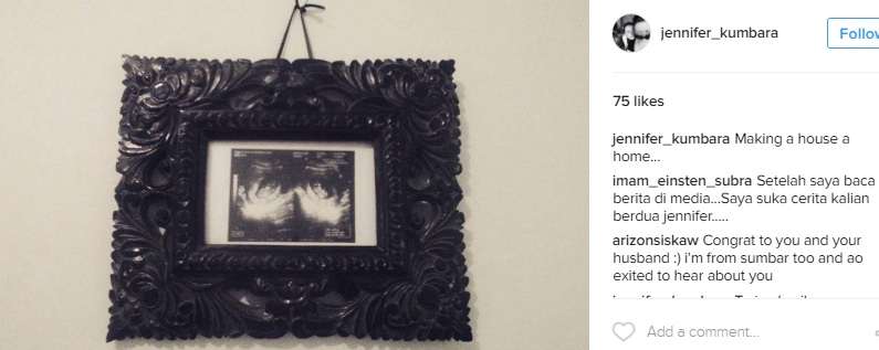 Foto usg buah hati Bayu-Jennifer