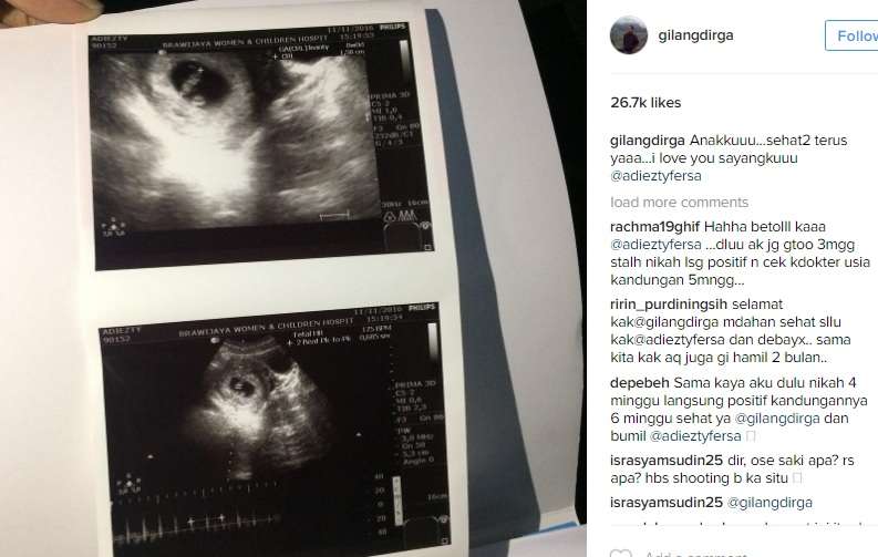 Unggahan Gilang Dirga Unggahan Gilang Dirga