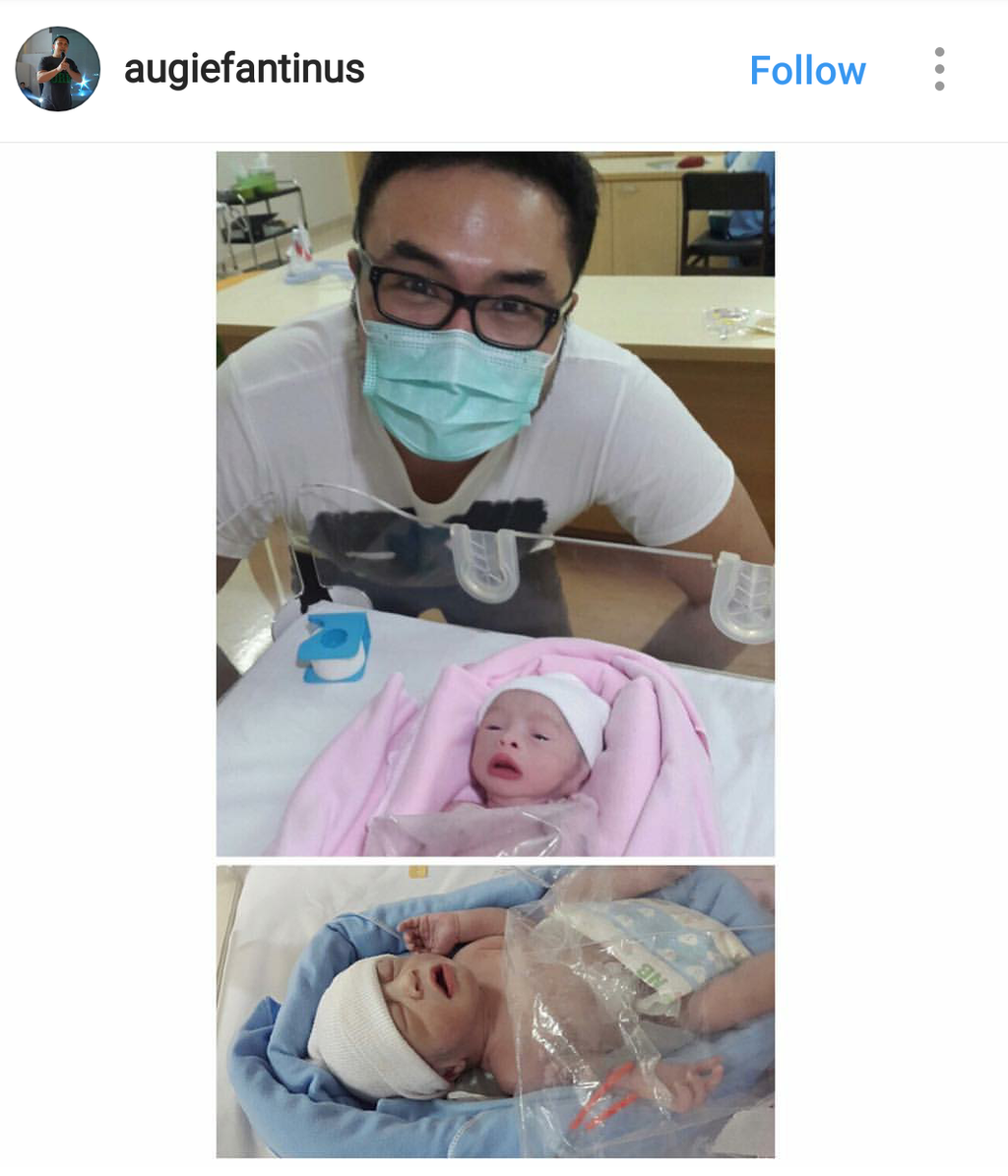 Bayi Kembar Cynthia dan Surya