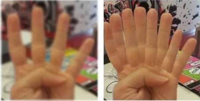 Derita Orang Berkacamata