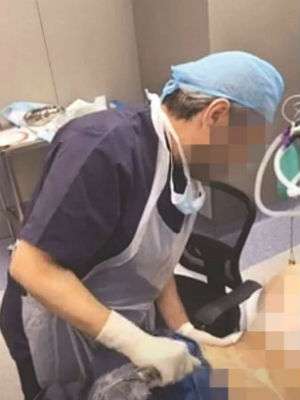 Video sedot lemak dokter ini memicu kontroversi