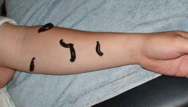 Treantment Kecantikan Ekstrem