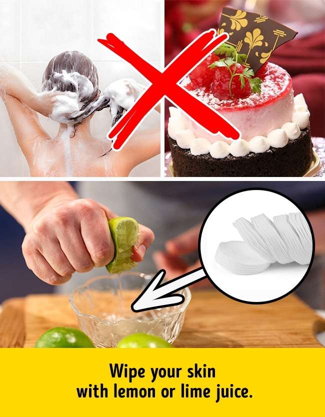 Penyebab Jerawat Penyebab Jerawat