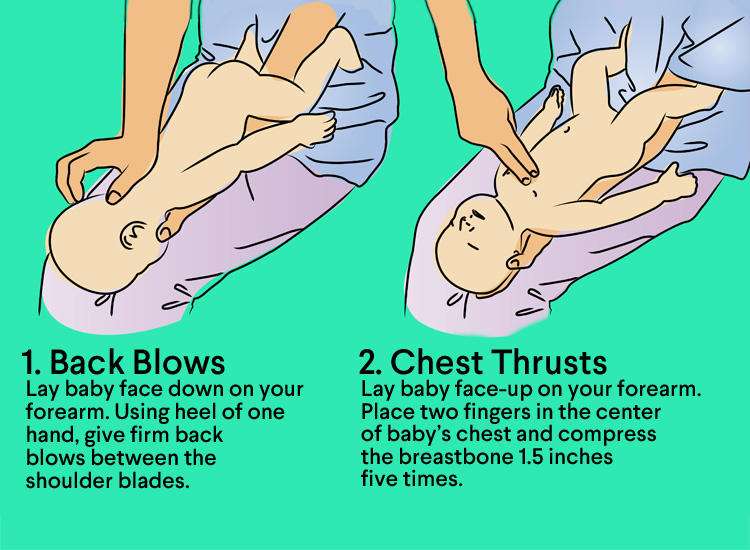 CPR pada bayi