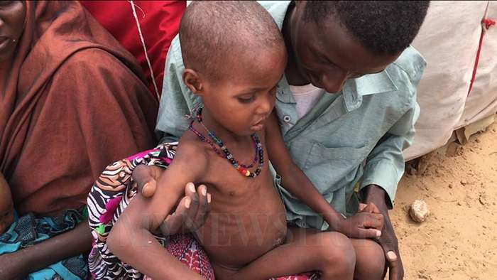 Krisis Somalia