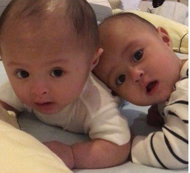bayi kembar surya