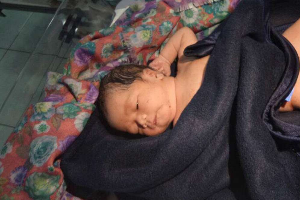 Bayi yang dilahirkan di pinggir tol Cipali