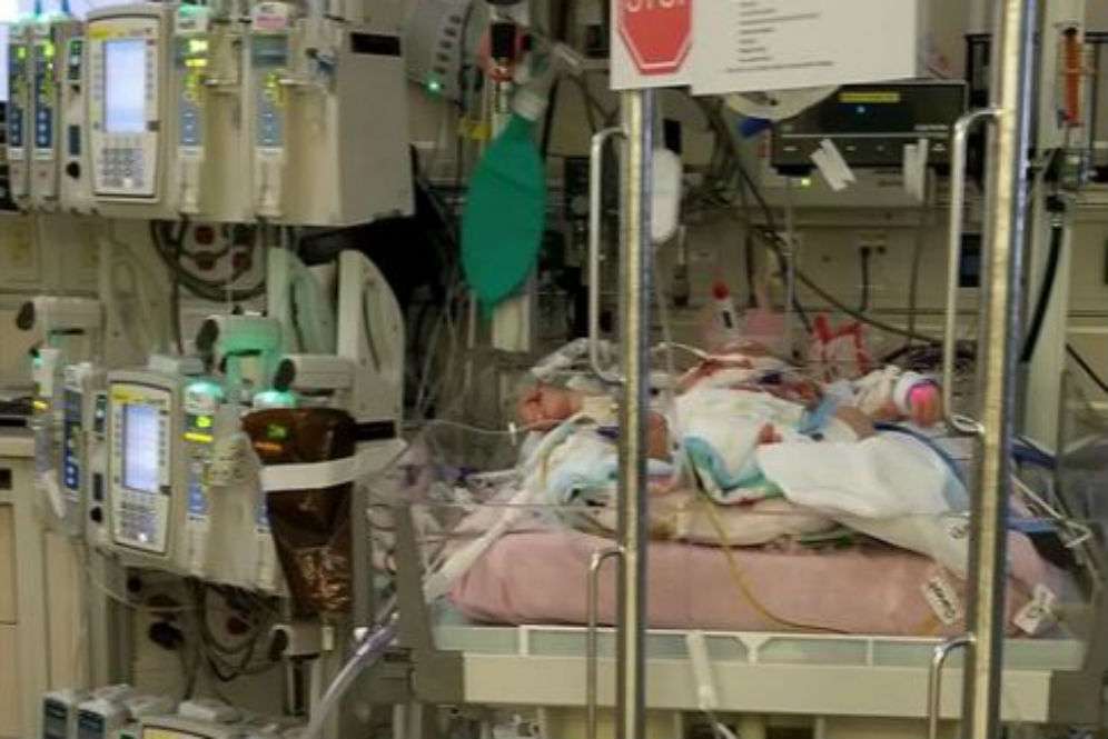 Bayi Mariana dirawat di NICU