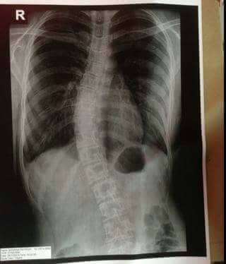 Patrisha Banawa Patrisha Banawa