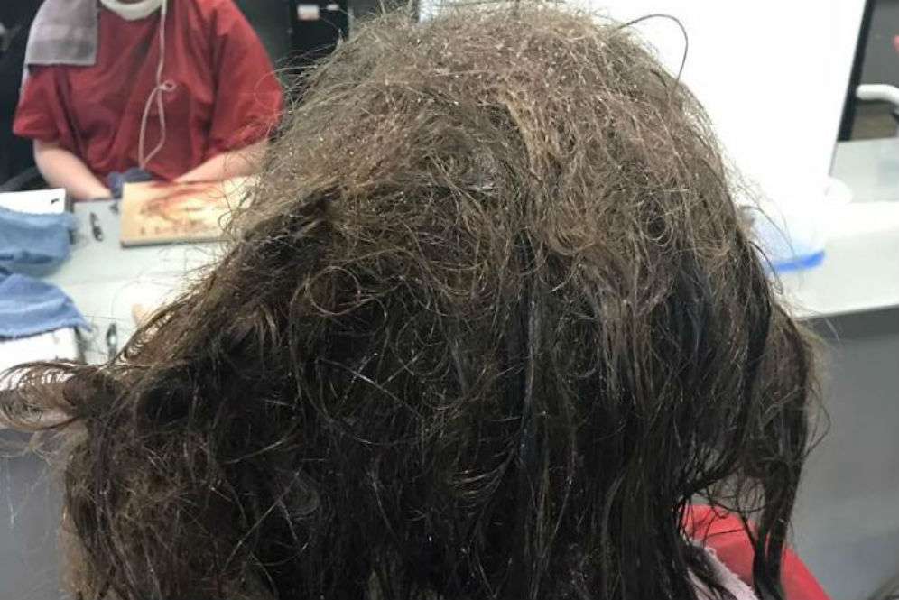 Rambut remaja yang depresi