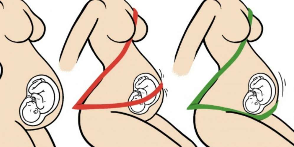 Pemakaian seat belt yang tepat pada ibu hamil