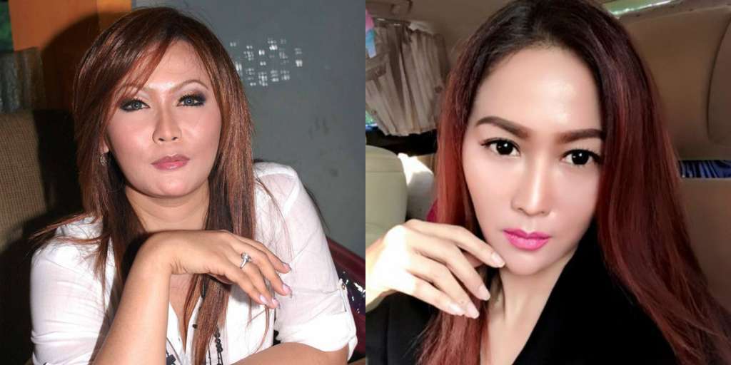 perubahan wajah Inul Daratista