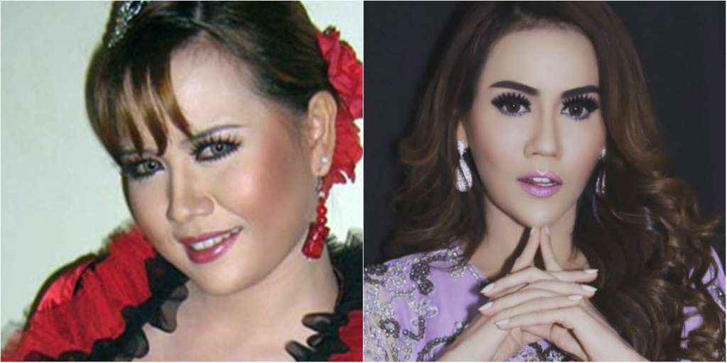 Perubahan wajah nita thalia