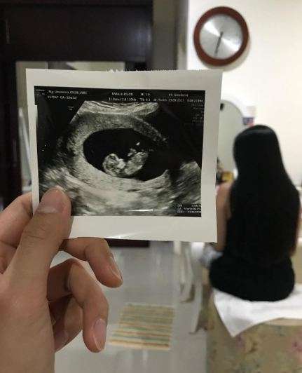 lucky perdana
