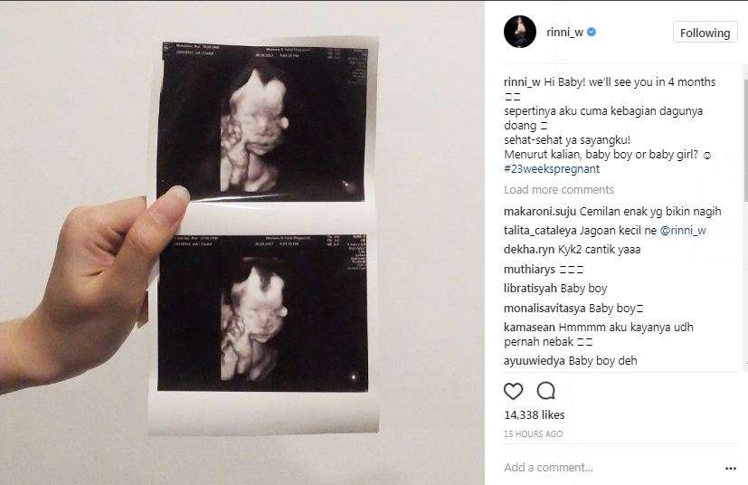 foto calon bayi rini wulandari
