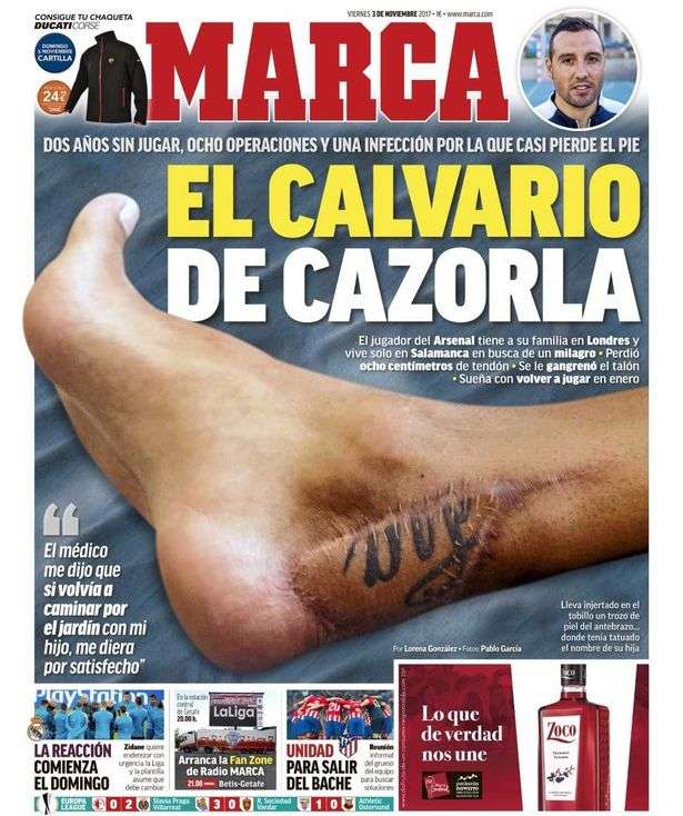 Tato di lengan berpindah ke kaki