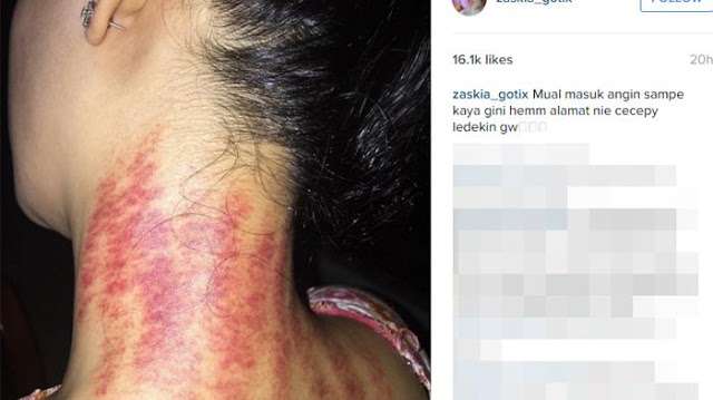 zaskia gotik