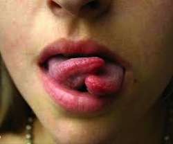 Tongue Twister