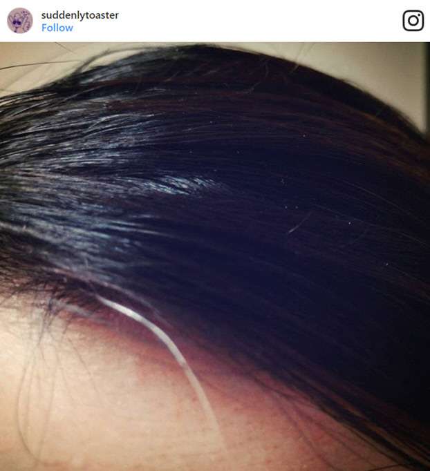 masalah_rambut_gelap_3