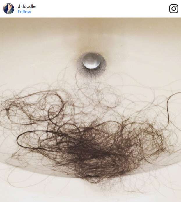 masalah_rambut_gelap_14