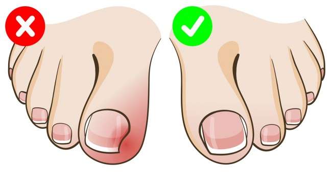 Kesalahan dalam membersihkan tubuh